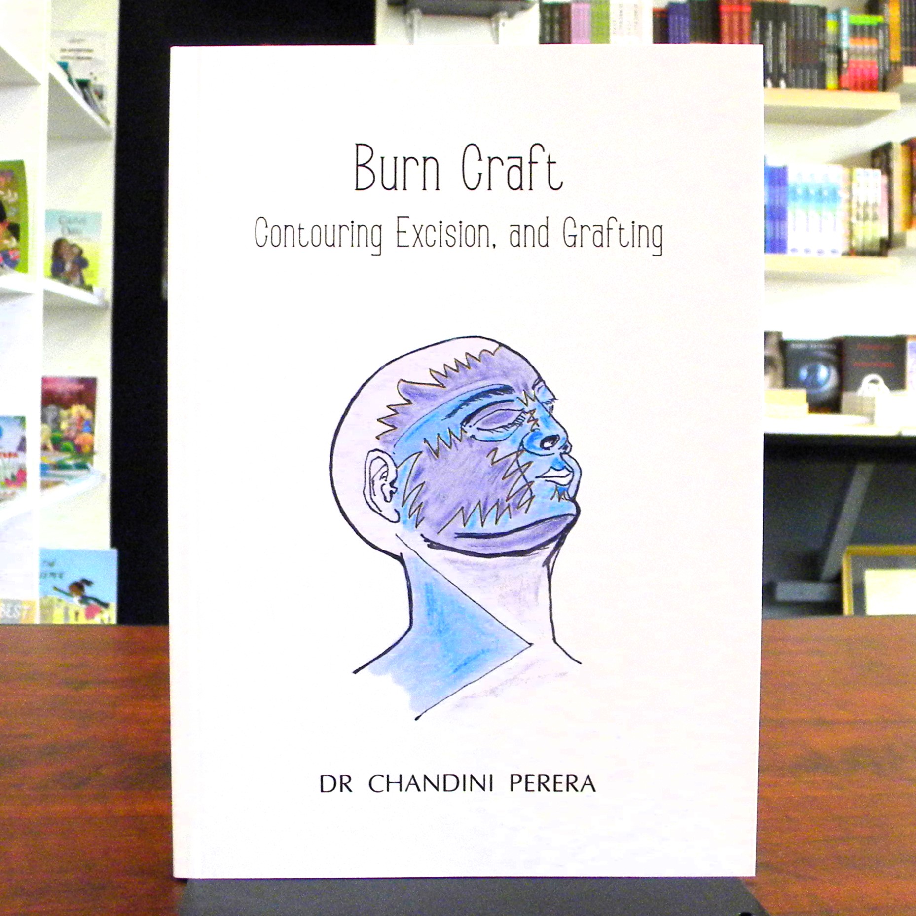 Burn Craft: A book that offers renewed hope for burn victims